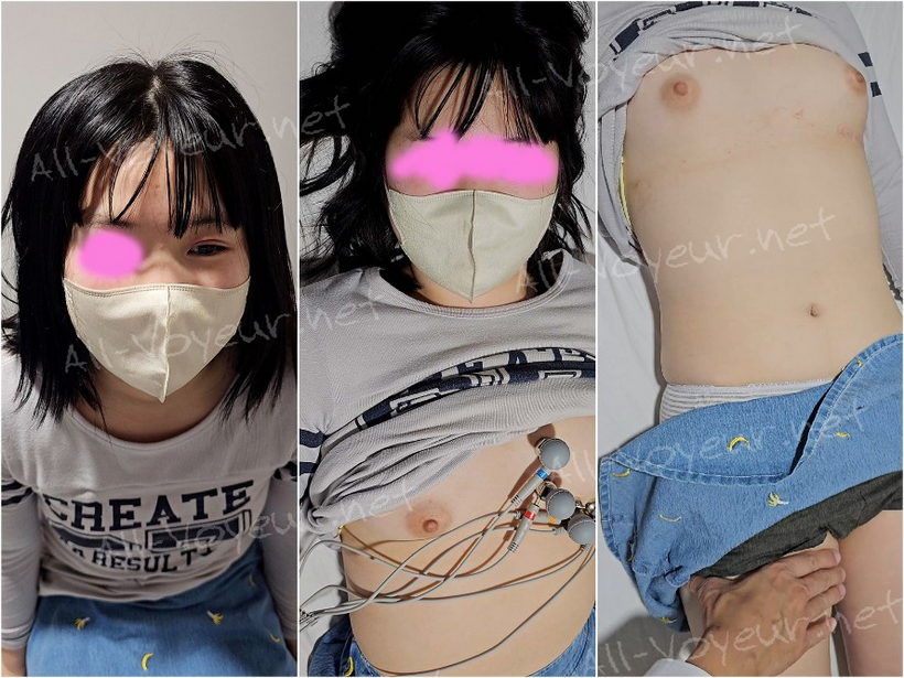 吸引具で真っ赤な跡が付いてしまったティーン患者の心電図検査。ピンク乳輪をもつおさな顔患者の胸を盗撮！